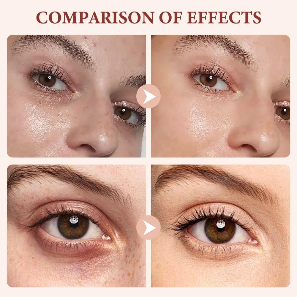 Bright Eye CC